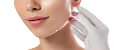 Fadenlifting in Wien