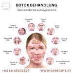 Botox-Behandlungen