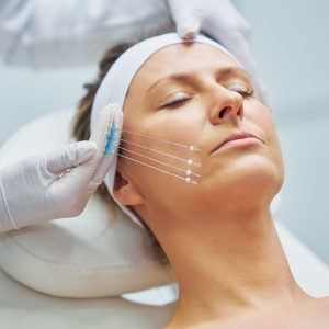 Fadenlifting in Wien